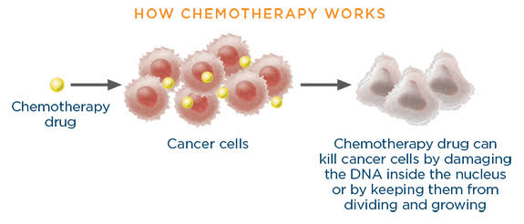 Chemotherapy 