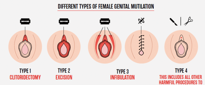 Female genital mutilation মেয়েদের খতনা