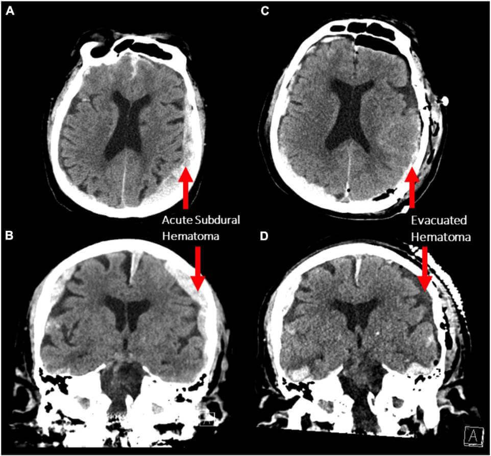 মৃত্যু-স্মৃতি-মস্তিষ্ক-death-brain-memory