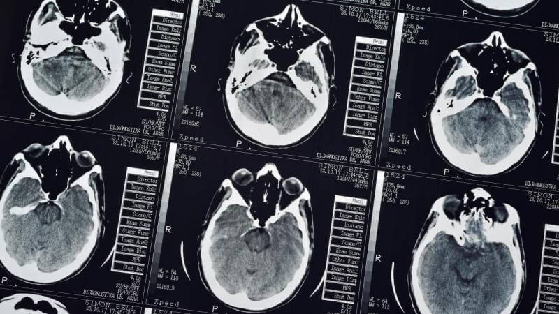 মৃত্যু-স্মৃতি-মস্তিষ্ক-death-brain-memory