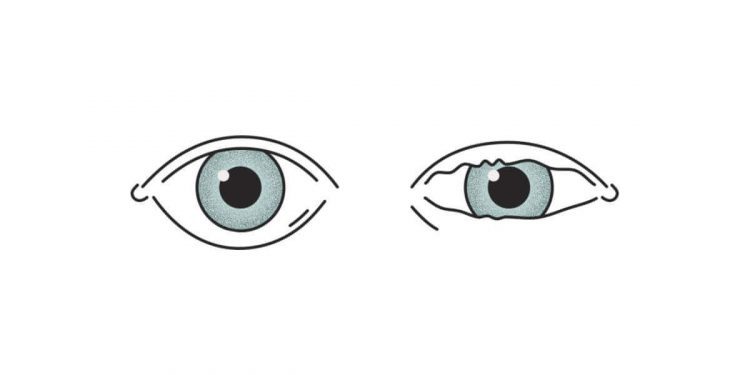 Science Bee Daily Science eye twitching