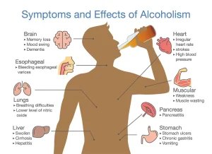 Auto Brewery Syndrome Science bee science news